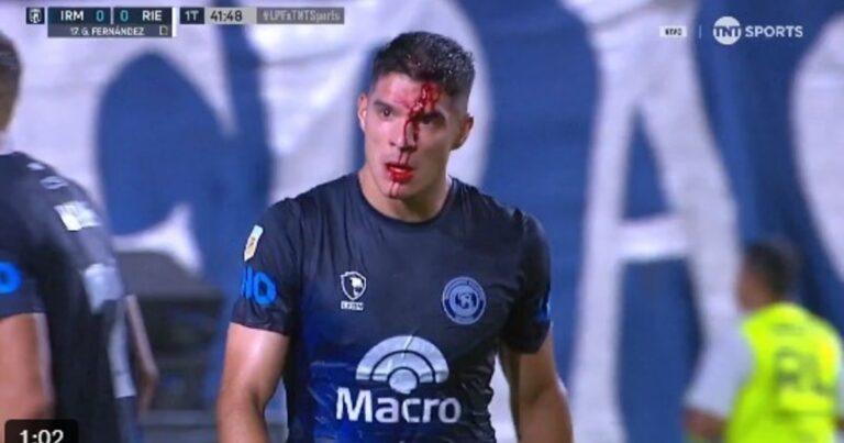 Insólito: un jugador de Riestra le abrió la cabeza a un rival de un codazo, el VAR no intervino y apenas fue amonestado