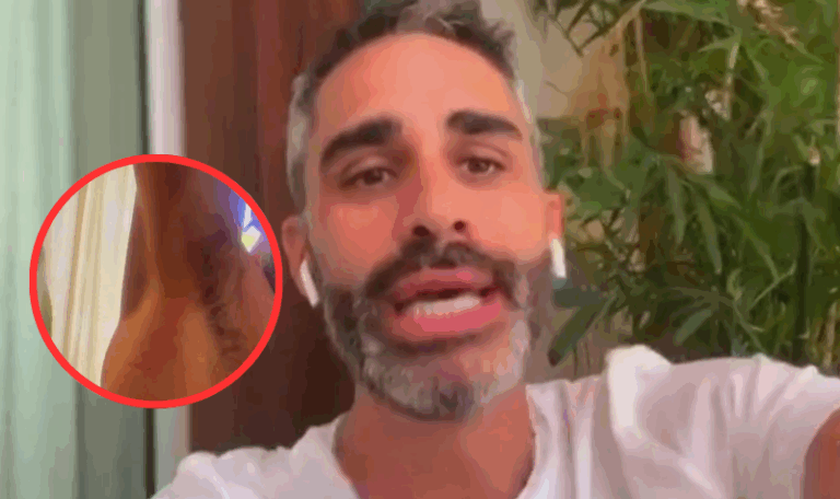Cómo fue el terrible accidente que sufrió el Pollo Álvarez en un boliche de Miami