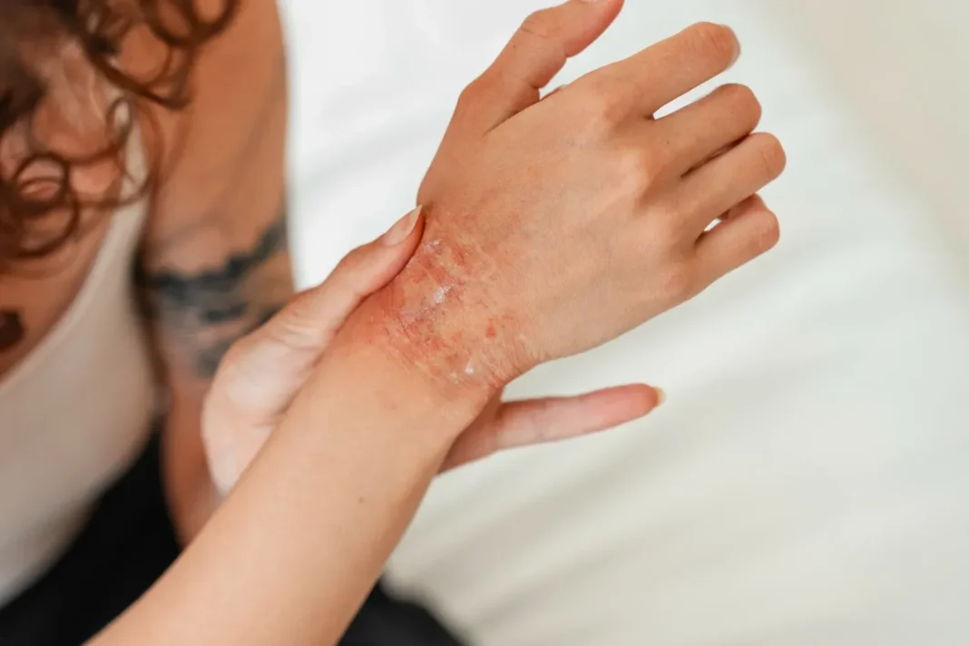 Médico dermatólogo realizando consulta a paciente